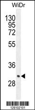 Anti-ZC4H2 Rabbit Polyclonal Antibody