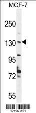 Western blot analysis in MCF-7 cell line lysates (35 µg/lane)