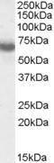 Anti-IKZF1 antibody