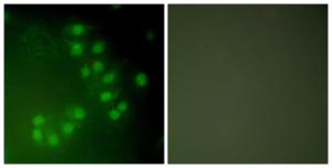 Antibody anti-P63 100 µg