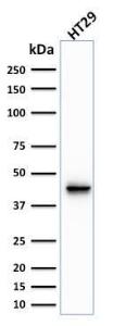 Anti-Cytokeratin 20 Mouse Monoclonal Antibody [clone: KRT20/1991]