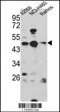 Anti-MED6 Rabbit Polyclonal Antibody