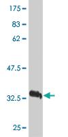 Anti-VEGFB Mouse Monoclonal Antibody [clone: 4H5]