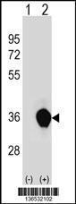 Anti-UNKL Rabbit Polyclonal Antibody (APC (Allophycocyanin))