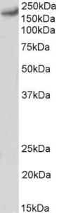 Antibody anti-CACNA1C 100 µg