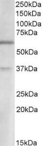 Anti-SLC17A6 Antibody (A85137) (2µg/ml) staining of Human Cerebellum lysate (35µg protein in RIPA buffer). Primary incubation was 1 hour. Detected by chemiluminescence.