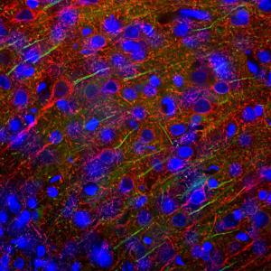 Immunofluorescent analysis of cortex section of rat brain stained using Anti-ANK-3 Antibody [2A8] (A270548), at a dilution of 1:2,000, in green and co-stained using Anti-NF-L Antibody (A85451), at a dilution of 1:5000 in red.