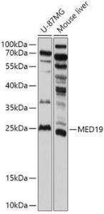 Western blot analysis of extracts of various cell lines, using Anti-MED19 Antibody (A305321) at 1:1,000 dilution. The secondary antibody was Goat Anti-Rabbit IgG H&L Antibody (HRP) at 1:10,000 dilution.