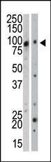 Anti-MAP3K12 Rabbit Polyclonal Antibody (HRP (Horseradish Peroxidase))