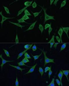 Immunofluorescence analysis of L929 cells using Anti-CNNM1 Antibody (A93198) at a dilution of 1:100 DAPI was used to stain the cell nuclei (blue)