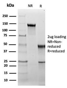 SDS-PAGE analysis of Anti-HSP60 Antibody [rHSPD1/6495] under non-reduced and reduced conditions; showing intact IgG and intact heavy and light chains, respectively. SDS-PAGE analysis confirms the integrity and purity of the antibody