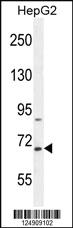 Anti-KDM6B Rabbit Polyclonal Antibody