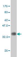 Anti-IKBKAP Mouse Monoclonal Antibody [clone: 6G9]