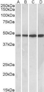 Anti-BEND5 Antibody (A85138) (0.3 µg/ml) staining of Daudi (A), Human Tonsil (B), Human Spleen (C) and Mouse Spleen (D) lysates (35 µg protein in RIPA buffer). Primary incubation was 1 hour. Detected by chemilu minescence