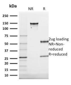 Anti-Cytokeratin 20 Mouse Monoclonal Antibody [clone: KRT20/1991]