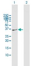 Anti-SDSL Mouse Polyclonal Antibody