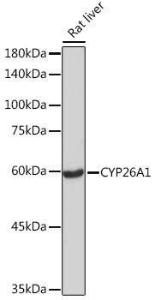 Anti-CYP26A1 Rabbit Monoclonal Antibody [clone: ARC2126]