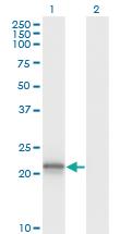 Anti-VHL Mouse Monoclonal Antibody [clone: 1G12]