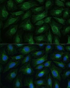 Immunofluorescence analysis of U-2 OS cells using Anti-CNNM1 Antibody (A93198) at a dilution of 1:100 DAPI was used to stain the cell nuclei (blue)