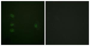 Immunofluorescence analysis of HepG2 cells using Anti-NPM Antibody The right hand panel represents a negative control, where the antibody was pre-incubated with the immunising peptide