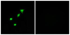 Immunofluorescence analysis of A549 cells using Anti-REQU Antibody. The right hand panel represents a negative control, where the antibody was pre-incubated with the immunising peptide