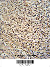 Anti-GSDMC Rabbit Polyclonal Antibody