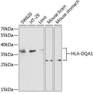 Western blot analysis of extracts of various cell lines, using Anti-HLA-DQA1 Antibody (A9002) at 1:1,000 dilution