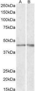 Anti-NPHS2 Antibody (A85139) (03 µg/ml) staining of Human (A) and Mouse (B) Kidney lysates (35 µg protein in RIPA buffer) Primary incubation was 1 hour Detected by chemiluminescence