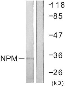 Western blot analysis of lysates from Jurkat cells using Anti-NPM Antibody The right hand lane represents a negative control, where the antibody is blocked by the immunising peptide