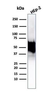 Western blot analysis of Hep2 cell lysate using Anti-HSP60 Antibody [rHSPD1/6495]