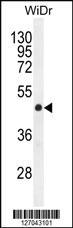 Anti-GSDMC Rabbit Polyclonal Antibody