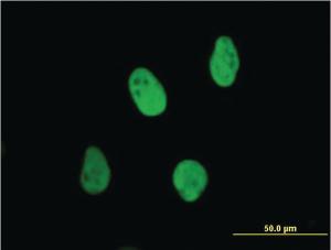 Anti-XRCC6 Mouse Monoclonal Antibody [clone: 4C2-1A6]