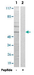 Anti-CYP2B6 Rabbit Polyclonal Antibody