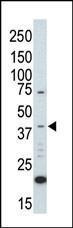 Anti-MAP Kinase 1 Rabbit Polyclonal Antibody (Biotin)