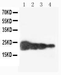 Anti-Growth Hormone Rabbit Polyclonal Antibody