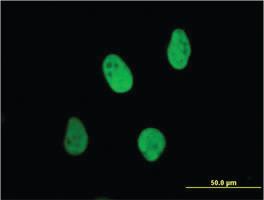 Anti-XRCC6 Mouse Monoclonal Antibody [clone: 4C2-1A6]