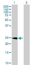 Anti-CPSF4 Mouse Polyclonal Antibody