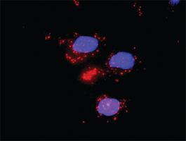 Anti-IL6 + ZBTB16 Antibody Pair