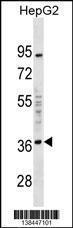 Anti-EDA2R Rabbit Polyclonal Antibody (Biotin)