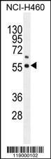 Anti-COQ6 Rabbit Polyclonal Antibody (PE (Phycoerythrin))