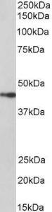 Anti-NPHS2 Antibody (A85139) (1 µg/ml) staining of Pig Kidney lysates (35 µg protein in RIPA buffer) Primary incubation was 1 hour Detected by chemiluminescence