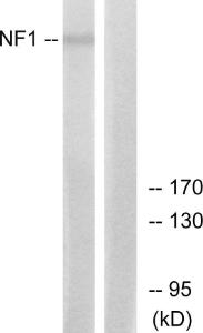 Western blot analysis of lysates from HepG2 cells using Anti-NF1 Antibody. The right hand lane represents a negative control, where the Antibody is blocked by the immunising peptide