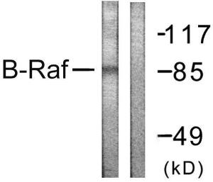 Western blot analysis of lysates from K562 cells using Anti-B-RAF Antibody. The right hand lane represents a negative control, where the antibody is blocked by the immunising peptide