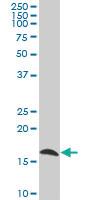 Anti-ARPC5 Mouse Polyclonal Antibody