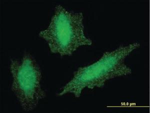 Anti-VHL Mouse Monoclonal Antibody [clone: 1G12]