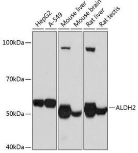 Anti-ALDH2 antibody