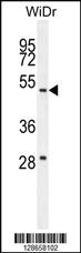 Anti-RT4I1 Rabbit Polyclonal Antibody