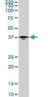 Anti-PTX3 Mouse Monoclonal Antibody [clone: 2B10]