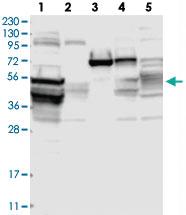 Anti-C9 Rabbit Polyclonal Antibody