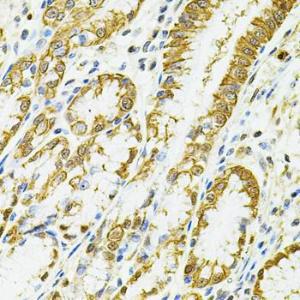 Immunohistochemistry analysis of paraffin-embedded human esophagus using Anti-HLA-DQA1 Antibody (A9002) at a dilution of 1:100 (40X lens). Perform microwave antigen retrieval with 10 mM PBS buffer pH 7.2 before commencing with IHC staining protocol